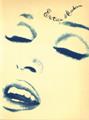 Fever Noter